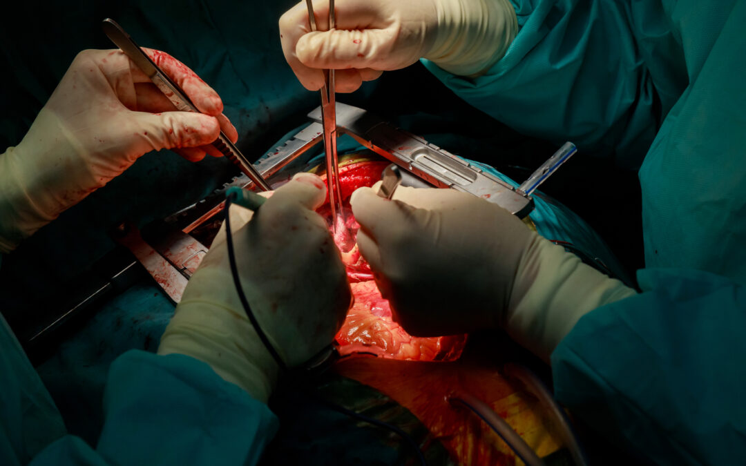 جراحة الشرايين التاجية بدون مضخة